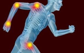 Die Gründe für die Entwicklung von Arthrose und Arthrose