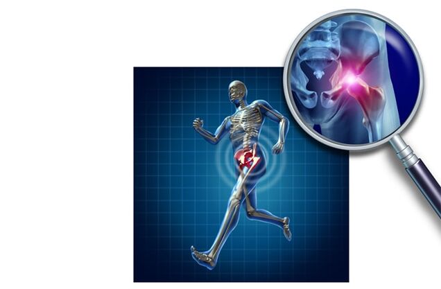 Schmerzen beim Laufen im Hüftgelenk